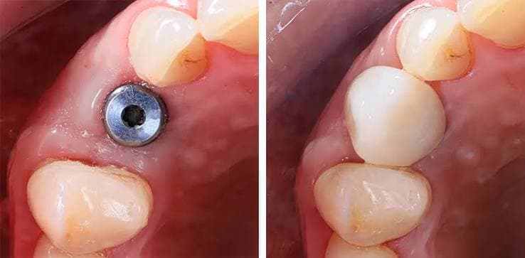 Implants & Oral Surgery